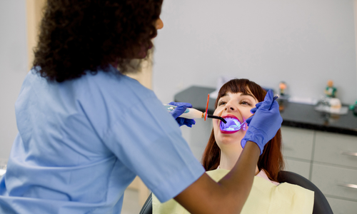 Композитный бондинг