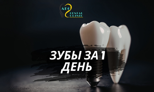 Зубы за 1 день: All-on-4