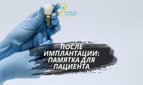 Инструкция после имплантации