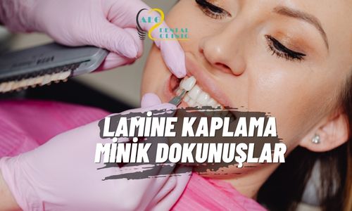 Lamine ile Doğal Gülüş Tasarımı