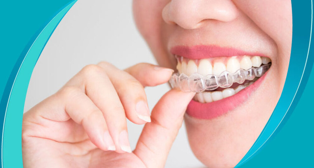 Ортодонтия