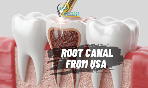 Endodontics & Patient Stories