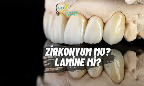 Zirkonyum vs Lamine Karşılaştırması